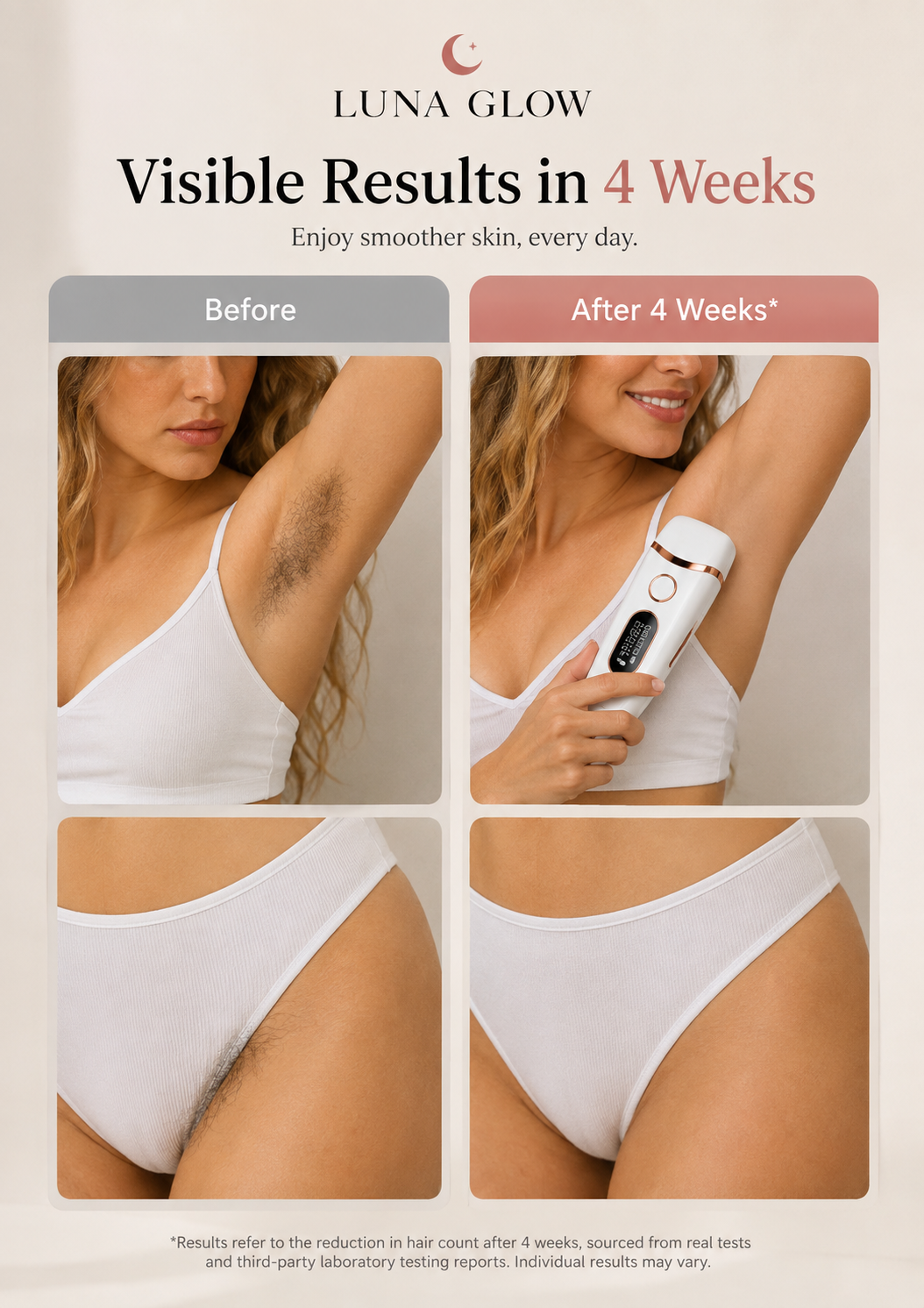 Luna Glow™ IPL Silk Pro
